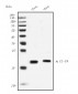 Anti- IL-18 Monoclonal Antibody