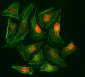 Anti-RPA32/RPA2 Antibody Picoband™ (monoclonal, 3B2E9)
