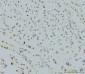 Anti-RPA32/RPA2 Antibody Picoband™ (monoclonal, 3B2E9)