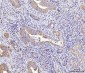 Anti-Glutaminase/GLS Antibody Picoband™ (monoclonal, 3G13)