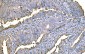 Anti-Prothrombin Antibody Picoband™ (monoclonal, 4G13G9)