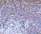 Anti-Filamin B/FLNB Antibody Picoband™ (monoclonal, 11E2D2)