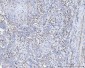 Anti-FACL4/ACSL4 Antibody Picoband™ (monoclonal, 4I7)
