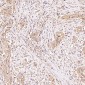 Anti-p57 Kip2 Rabbit Monoclonal Antibody