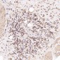 Anti-FOXP3 Rabbit Monoclonal Antibody
