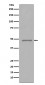 Anti-FOXP3 Rabbit Monoclonal Antibody