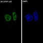 Anti-ARID1A Rabbit Monoclonal Antibody
