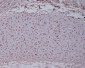 Anti-Aggrecan Rabbit Monoclonal Antibody