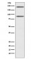 Anti-C4 Rabbit Monoclonal Antibody