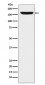 Anti-REST / NRSF Rabbit Monoclonal Antibody