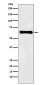 Anti-Factor IX Rabbit Monoclonal Antibody 