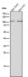 Anti-TPOR Rabbit Monoclonal Antibody