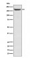 Anti-IRS2 Rabbit Monoclonal Antibody