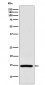 Anti-RPS19 Rabbit Monoclonal Antibody