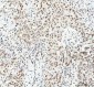 Anti-KAT8 / MYST1 / MOF Rabbit Monoclonal Antibody