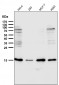 Anti-Destrin Rabbit Monoclonal Antibody