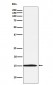 Anti-Ube2N / Ubc13 Rabbit Monoclonal Antibody
