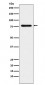 Anti-SUN2 Rabbit Monoclonal Antibody