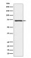 Anti-Guanylyl Cyclase beta 1 Rabbit Monoclonal Antibody