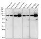Anti-Guanylyl Cyclase beta 1 Rabbit Monoclonal Antibody