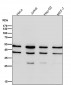 Anti-Lumican Rabbit Monoclonal Antibody