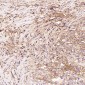 Anti-H Cadherin Rabbit Monoclonal Antibody