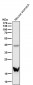 Anti-TAGLN Rabbit Monoclonal Antibody