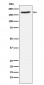 Anti-Aminopeptidase A / CD249 Rabbit Monoclonal Antibody