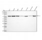 Anti-METTL3 Rabbit Monoclonal Antibody