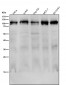 Anti-Cenexin1 / ODF2 Rabbit Monoclonal Antibody