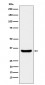 Anti-BOB1 Rabbit Monoclonal Antibody