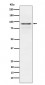Anti-RSK1 p90 Rabbit Monoclonal Antibody