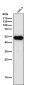Anti-ODC1 Rabbit Monoclonal Antibody