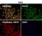 Anti-TOMM22/TOM22 Rabbit Monoclonal Antibody