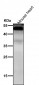 Anti-NFIB / NF1B2 Rabbit Monoclonal Antibody