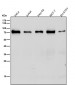 Anti-IL7R alpha/CD127 Rabbit Monoclonal Antibody