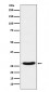 Anti-TCF21 Rabbit Monoclonal Antibody