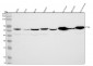 Anti-ATGL / PNPLA2 Rabbit Monoclonal Antibody