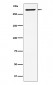 Anti-EDD Rabbit Monoclonal Antibody