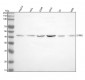 Anti-S1PR3 Rabbit Monoclonal Antibody