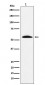 Anti-GGT1 Rabbit Monoclonal Antibody