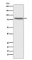 Anti-PSAP Rabbit Monoclonal Antibody
