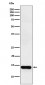 Anti-FABPI Rabbit Monoclonal Antibody