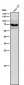 Anti-STK39 Rabbit Monoclonal Antibody