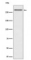 Anti-CD35 Rabbit Monoclonal Antibody