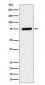 Anti-LPP Rabbit Monoclonal Antibody