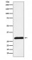 Anti-PRSS2 Rabbit Monoclonal Antibody