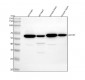 Anti-ACVR1 Rabbit Monoclonal Antibody