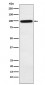 Anti-Complement factor B Rabbit Monoclonal Antibody
