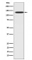 Anti-CC2D1A Rabbit Monoclonal Antibody